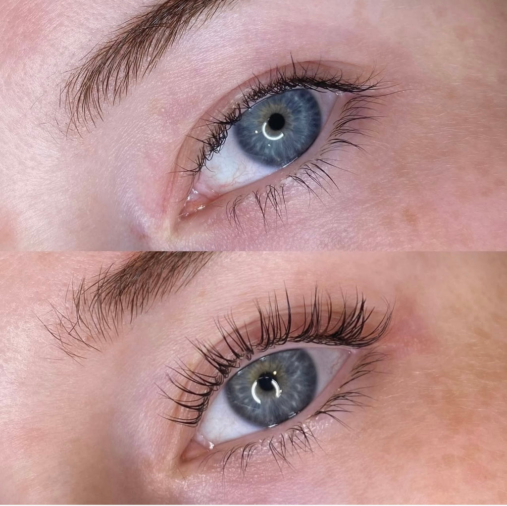 LASHIST™ Multi-Peptide Lash Growth Serum