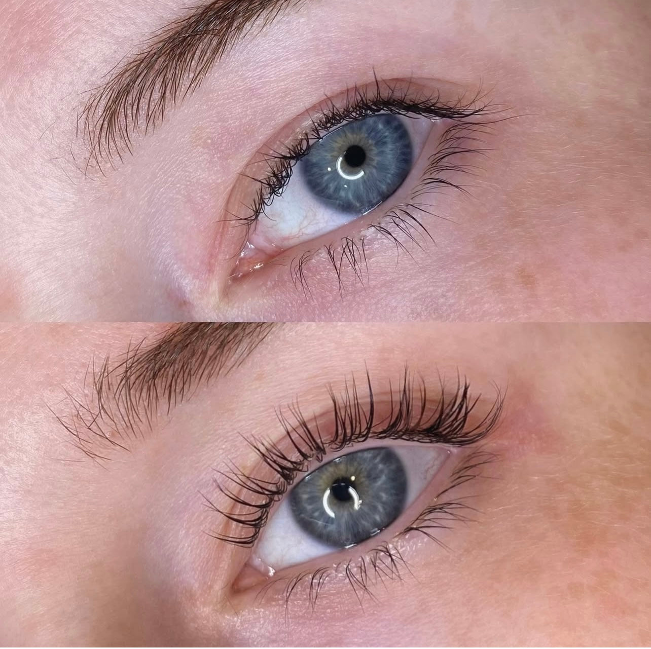 LASHIST™ Multi-Peptide Lash Growth Serum