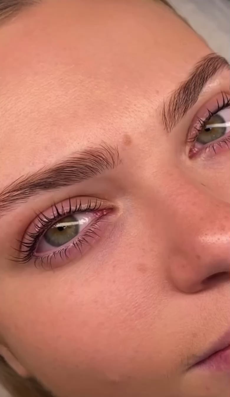 LASHIST™ Multi-Peptide Lash Growth Serum